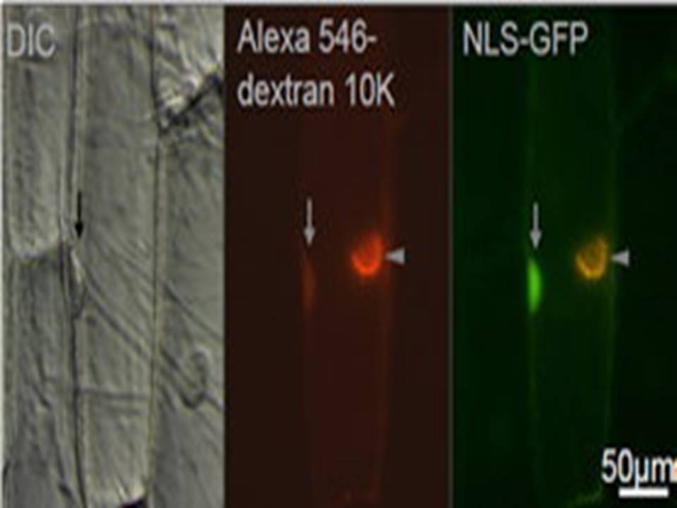 Injection of plasmids into a nucleus of onion epidermal cells